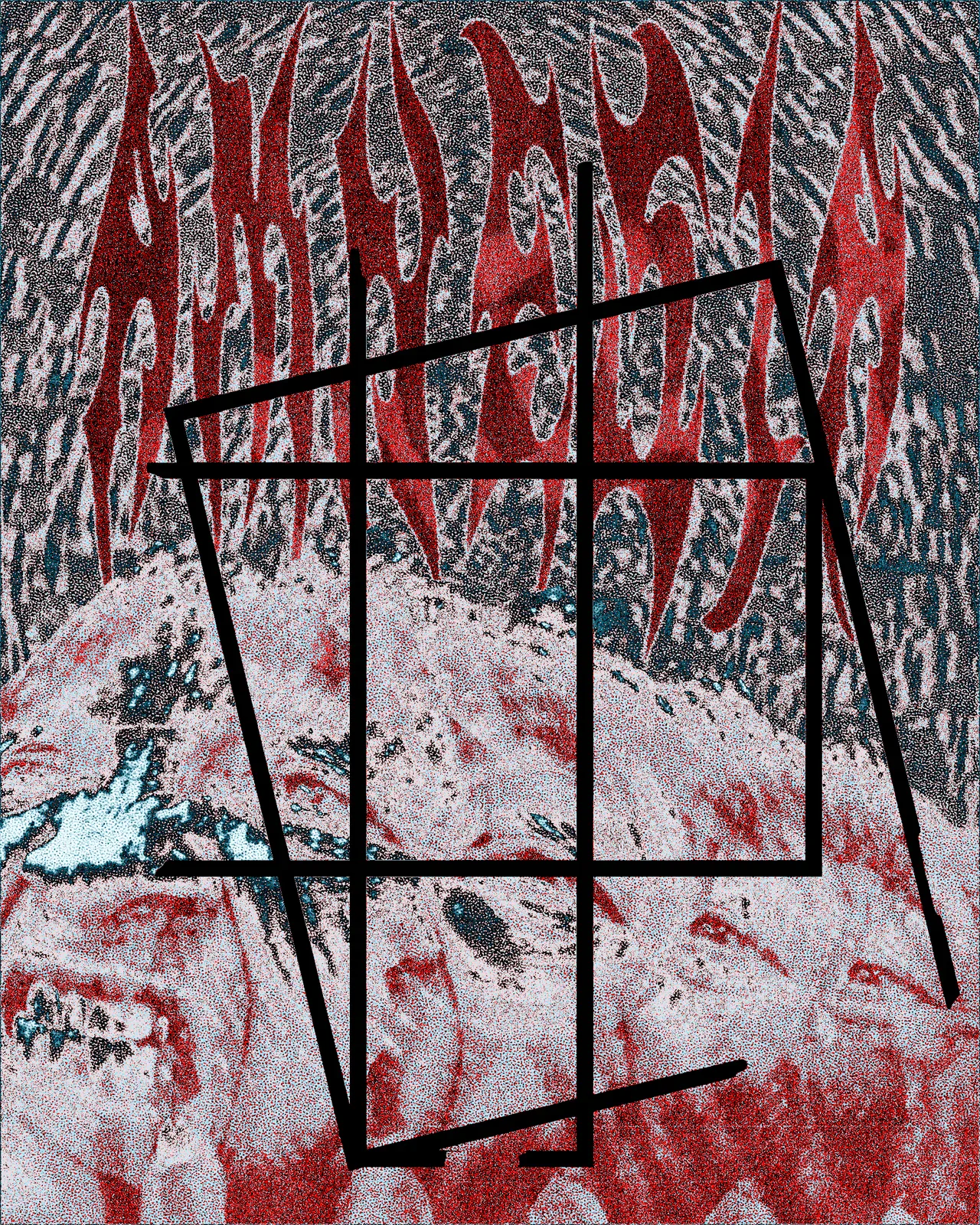 Amnesia